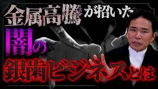 金属の高騰で銀歯が反社会勢力に狙われる！？誰かが気付く前に悪のスキームを公開します