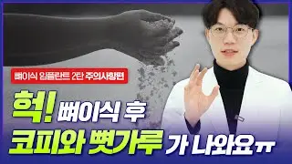 뼈이식 임플란트하고 나서 코피..? 얼굴에 멍..? 이거 뭐죠...😨?