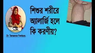 What to do if your baby has allergies?/ Causes & treatment of baby allergy.