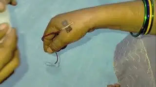 How To Insert Scalp Vein For IV Injection | Nursing Skill Demo#nursingskills