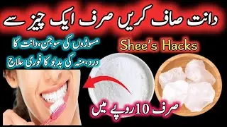Smartly Save Ur Money & Time with 1 Thing 😱 // How to Kitchen Clean & Organized //  Teeth Whitening