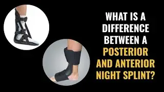 Night Splints - What is the difference between a posterior and anterior night splint?