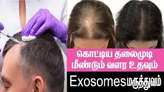 (exosomes) to stimulate hair follicle growth and improve scalp health || Dr.Sasi