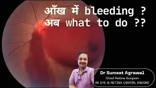 Retina में Bleeding ! क्या करे जब हो जाए Vitreous Hemorrhage ?