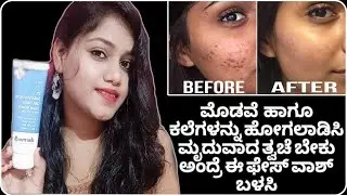 Dermaco 1% Salicylic acid Face wash Honest Review In Kannada||Not Sponsored||Best Facewash||