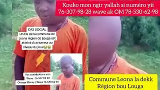 CAS SOCIAL UN FILS DE LA COMMUNE DE LEONA R&Eacute;GION DE LOUGA EST ATTEINT D'UN TUMEUR AU NIVEAU DE JOUE😭