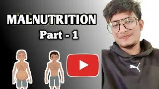 Protein Energy Malnutrition (PEM): Nursing School Nutrition Essentials Education |