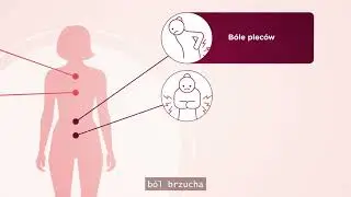 Heart attack symptoms in women (Polish language) Objawy zawału serca u kobiet