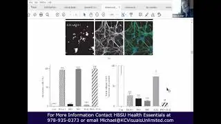 Immunotec - Raising Glutathone and Brain Health with Dr  Linesman