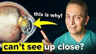 What Is Presbyopia & What Are The Solutions To Fix it?