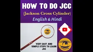 How to do Jackson's cross cylinder (in Hindi & English)