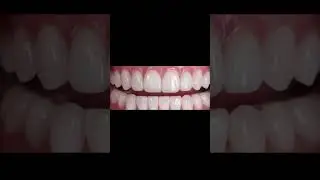 Advance Dental care at Your Family Dentist