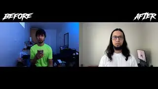 2 Years of Finasteride & Minoxidil: Hair Growth Before & After Timelapse