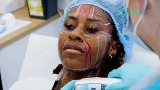 Elevate Your Beauty Career with VTCT Level 4 HiFu Training! - Cosmetic College