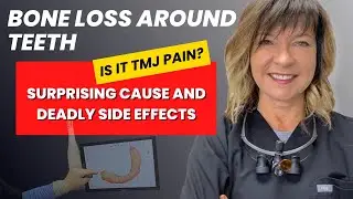 Bone Loss Around Teeth | TMJ Diagnosis & Treatment with #3shape and #Tekscan Dental