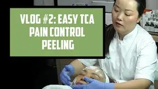 Vlog #2: Easy TCA Pain Control Peeling