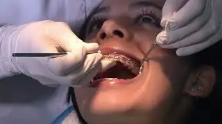 Smile Makeover