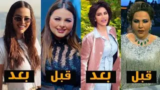 8 فنانين تحولو بعد فقدان وزنهم -2021
