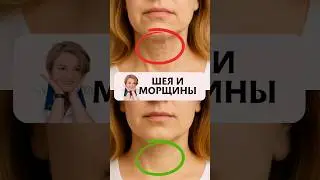 Тяжи на шее  #шеятяжи  #тяжинашее  #морщинынашее  #шея