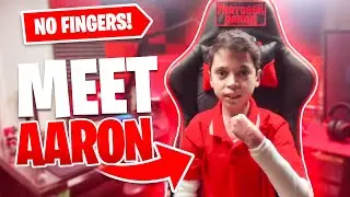 How I Play Fortnite with NO FINGERS! (My Story)