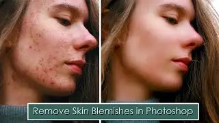 Easy Way to | Remove Skin Blemishes in Photoshop | Adobe Photoshop Tutorial. #photoshoptutorial