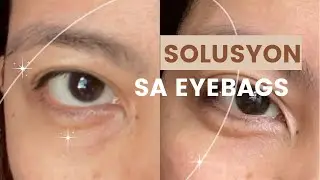 SOLUSYON SA EYE BAGS | Sinubukan Ko In 7Days | Eyes Up Lifting & Brightening Eye Serum by ELLANA