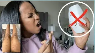 KENZZI LASER HAIR REMOVAL REVIEW ON BLACK SKIN (Not Sponsored) + Dealing W/ Hyperpigmentation