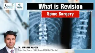 𝐖𝐡𝐚𝐭 𝐢𝐬 𝐑𝐄𝐕𝐈𝐒𝐈𝐎𝐍 𝐒𝐏𝐈𝐍𝐄 𝐒𝐔𝐑𝐆𝐄𝐑𝐘?  𝐃𝐫 𝐒𝐚𝐮𝐫𝐚𝐛𝐡 𝐊𝐚𝐩𝐨𝐨𝐫 𝐁𝐞𝐬𝐭 𝐒𝐩𝐢𝐧𝐞 𝐒𝐮𝐫𝐠𝐞𝐨𝐧 𝐢𝐧 𝐃𝐞𝐥𝐡𝐢