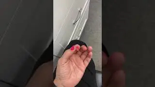 How To Strengthen Hand After Boxers Fracture