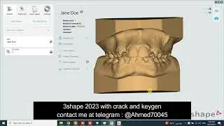 3shape full working