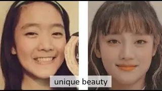 (G)I-DLE PLASTIC SURGERY ANALYSIS