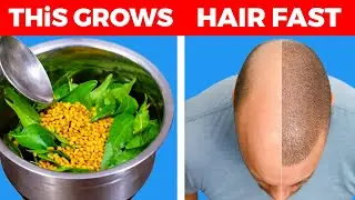 This Simple Homemade Remedy Grows Hair Fast | Stop Hair Fall Naturally
