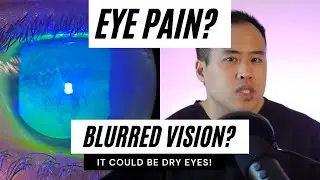 Dry Eyes? Eye Pain? Blurred Vision? Yes - It Can be Dry Eyes