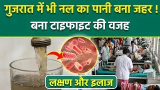 Gujarat Typhoid News: टाइफाइड क्या है, पानी से कैसे फैलता है | Symptoms And treatment In Hindi