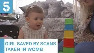 Doctors pioneer new method to detect heart defects in the womb | 5 News