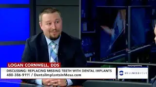 Discussing: Replacing Missing Teeth With Dental Implants
