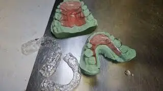 How to make Hawley's Upper and Lower Retainer Full Version