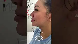 LIPO DE PAPADA RECUPERA&Ccedil;&Atilde;O -CRISALYS P&Oacute;S OPERAT&Oacute;RIO, CURSO P&Oacute;S OPERAT&Oacute;RIO E EST&Eacute;TICA