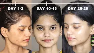 How to GLOW-UP in just 4 WEEKS | 100% WORKING | Anchal Shukla #nofilter