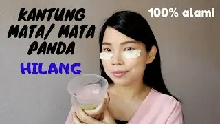CARA MENGHILANGKAN KANTUNG MATA HITAM/MATA PANDA DENGAN CEPAT DAN ALAMI | dr.Jessica Febrina