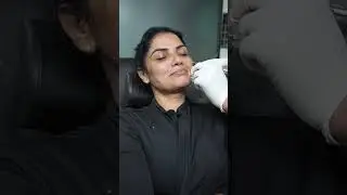 Face Filler treatment | Filler Treatment in Delhi