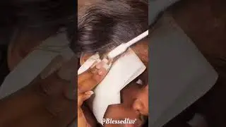 HACK Removing Lace Glue 👏🏼❤️