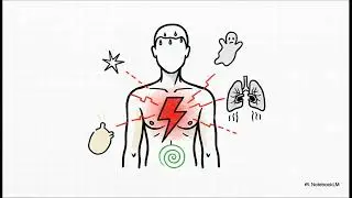 L'infarctus du myocarde : pathologies m&eacute;dicales