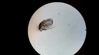 Cladoceran daphnia very healthy by micromax A110