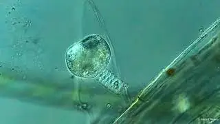 Vorticella - Stalk Contraction