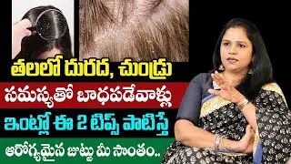 Dry Scalp Causes & Best Home Remedies | Tips by Nutritionist Vanaja Ramisetty
