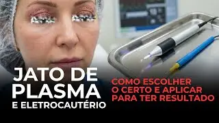 Jato de Plasma e Eletroccautério