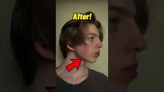 How to get a jawline