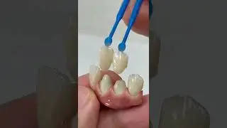 The most unique dental lab product!