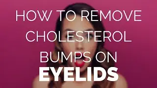 How to remove cholesterol bumps on eyelids easily with Xanthel.